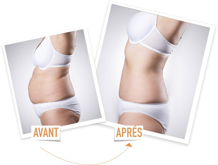 Effet-tenseur-ventre france